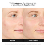Paula's Choice BOOST 10% Azelaic Acid Booster Cream Gel Serum