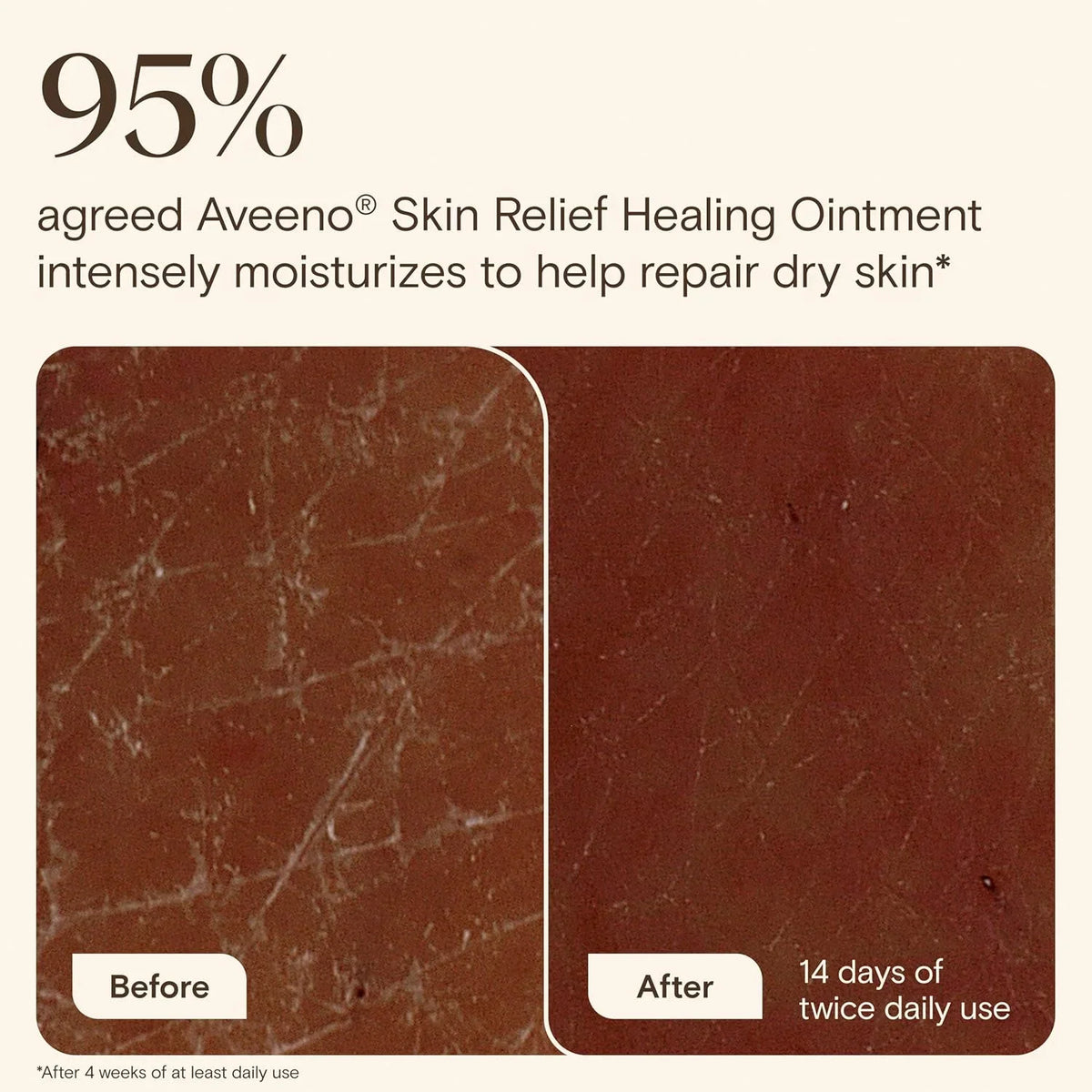 Aveeno Skin Relief Healing Ointment, Fragrance-Free, Jar 14 Ounce (Pack of 12)
