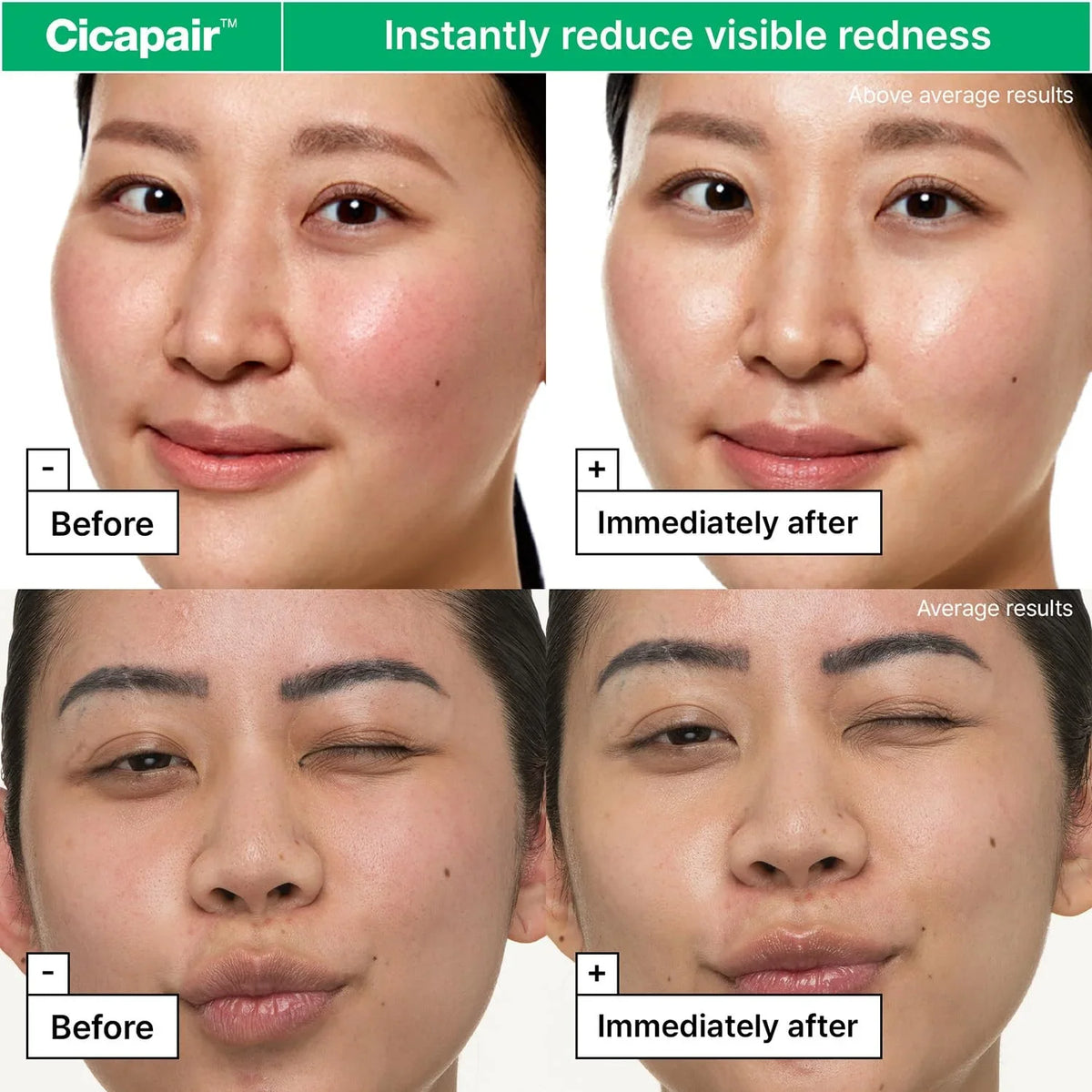 Dr.Jart+ Cicapair Sensitive Skin Korean Face Moisturizer for Redness and Barrier Repair with Centella Asiatica | Korean Skin Care
