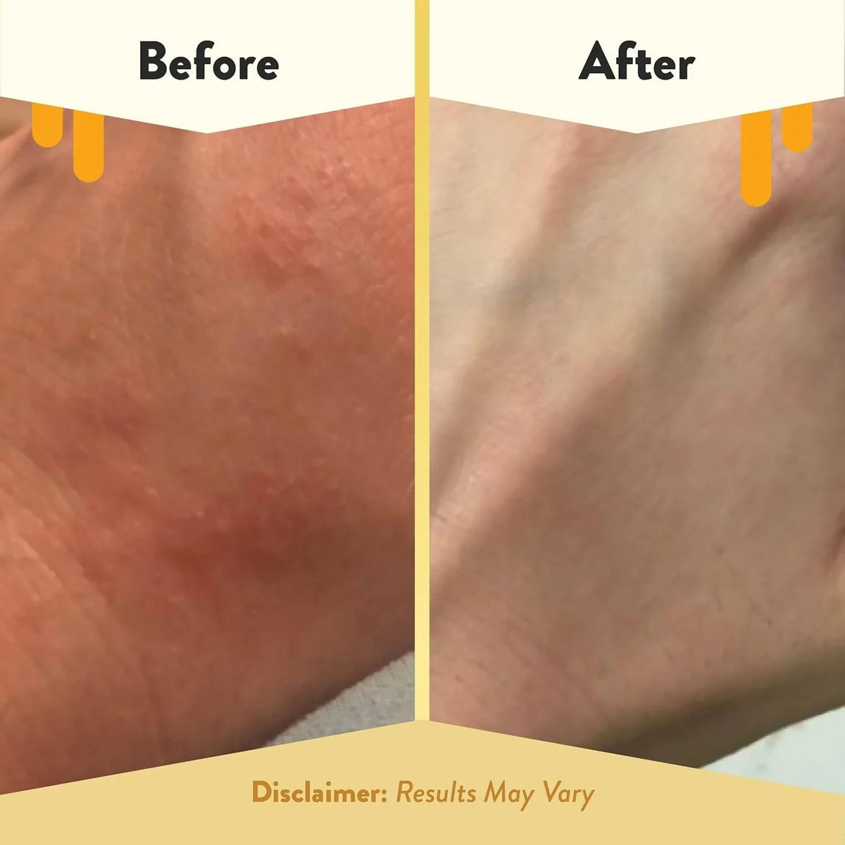 ECZEMA HONEY Oatmeal Body Lotion, Natural Dry Skin Repair (16 Oz)