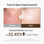 medicube Capsule Cream with Deep Vitamin C for Uneven Skin Tone & Texture