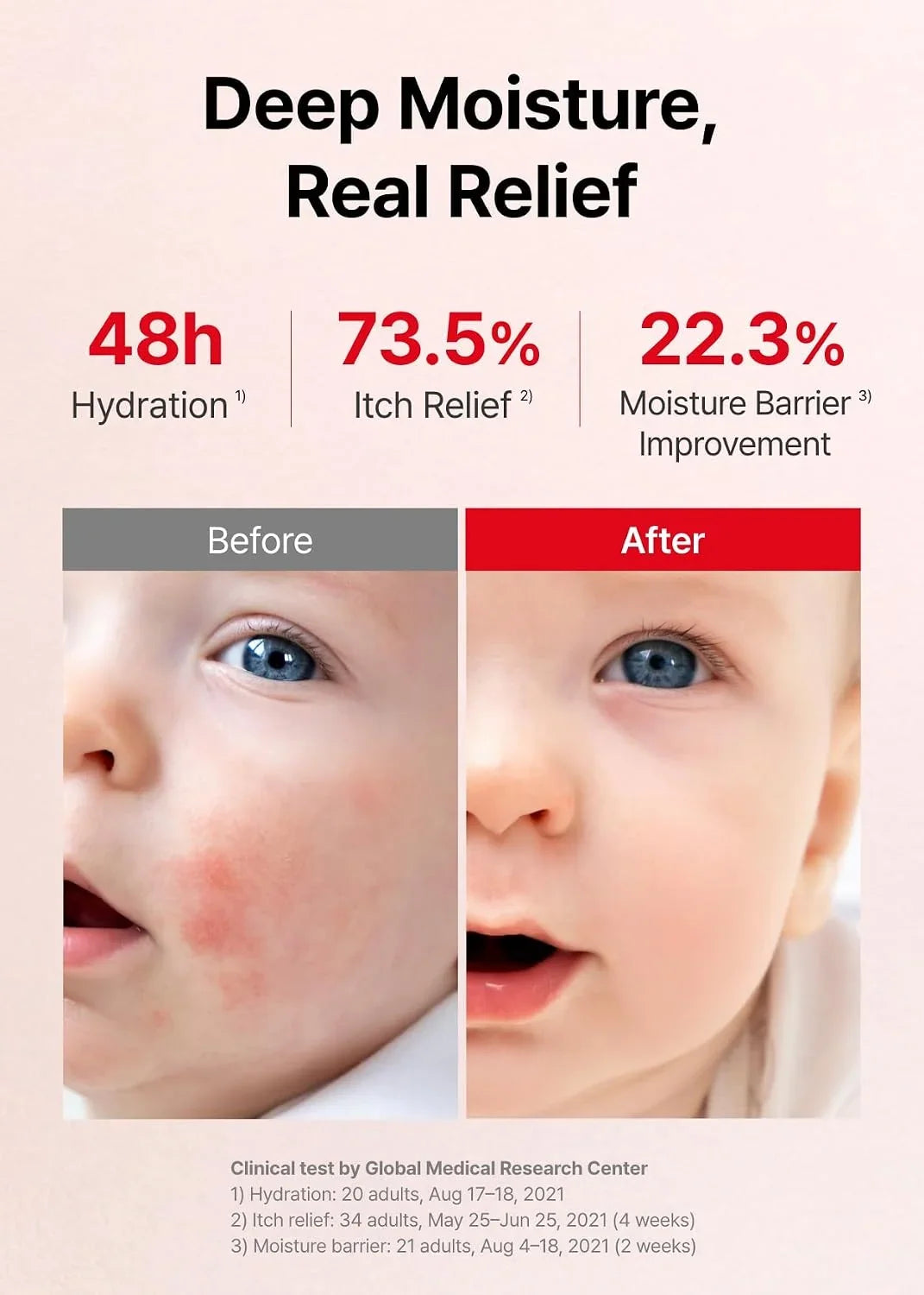 ATOPALM MLE Eczema Cream, 2.2 fl oz (65ml)