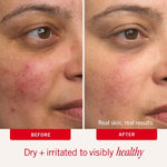 First Aid Beauty Ultra Repair Cream, Face Body Barrier Repair Moisturizer
