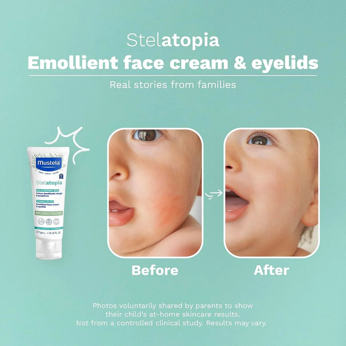 Mustela Stelatopia Eczema-Prone Skin Emollient Baby Face Cream - Face Moisturizer with Natural Avocado & Sunflower Oil - Fragrance-Free - 1.35 Fl Oz (Pack of 1)