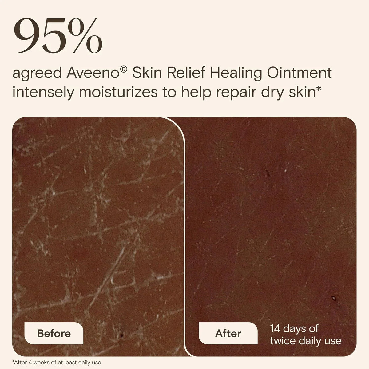 Aveeno Skin Relief Healing Ointment, Fragrance-Free, Jar 14 Ounce (Pack of 12)