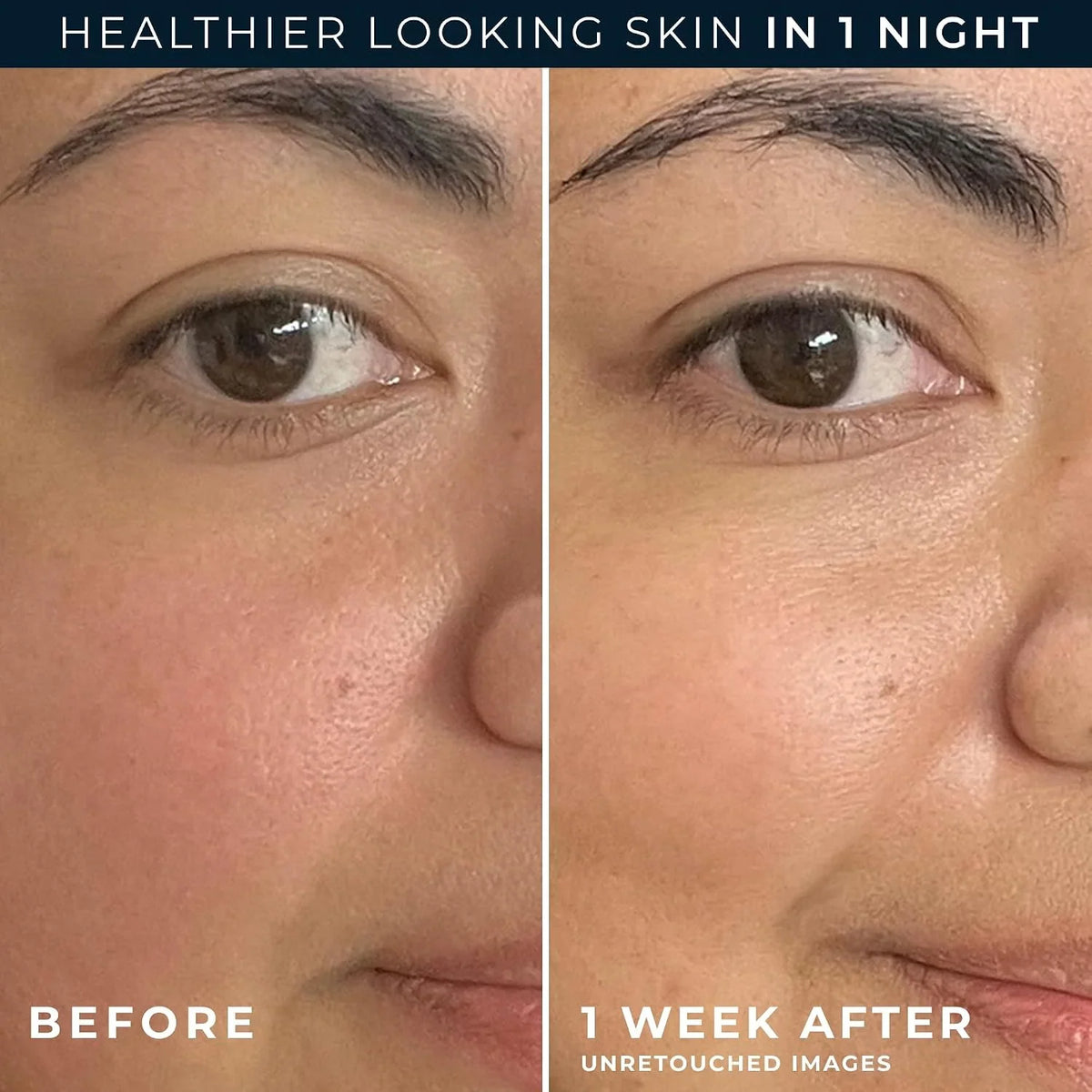 RoC Skin Barrier Renew Night Moisturizer with Ceramides & Peptides, 2.5 oz