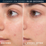 RoC Barrier Renew Gel to Foam Facial Cleanser, Sensitive Skin, non-drying