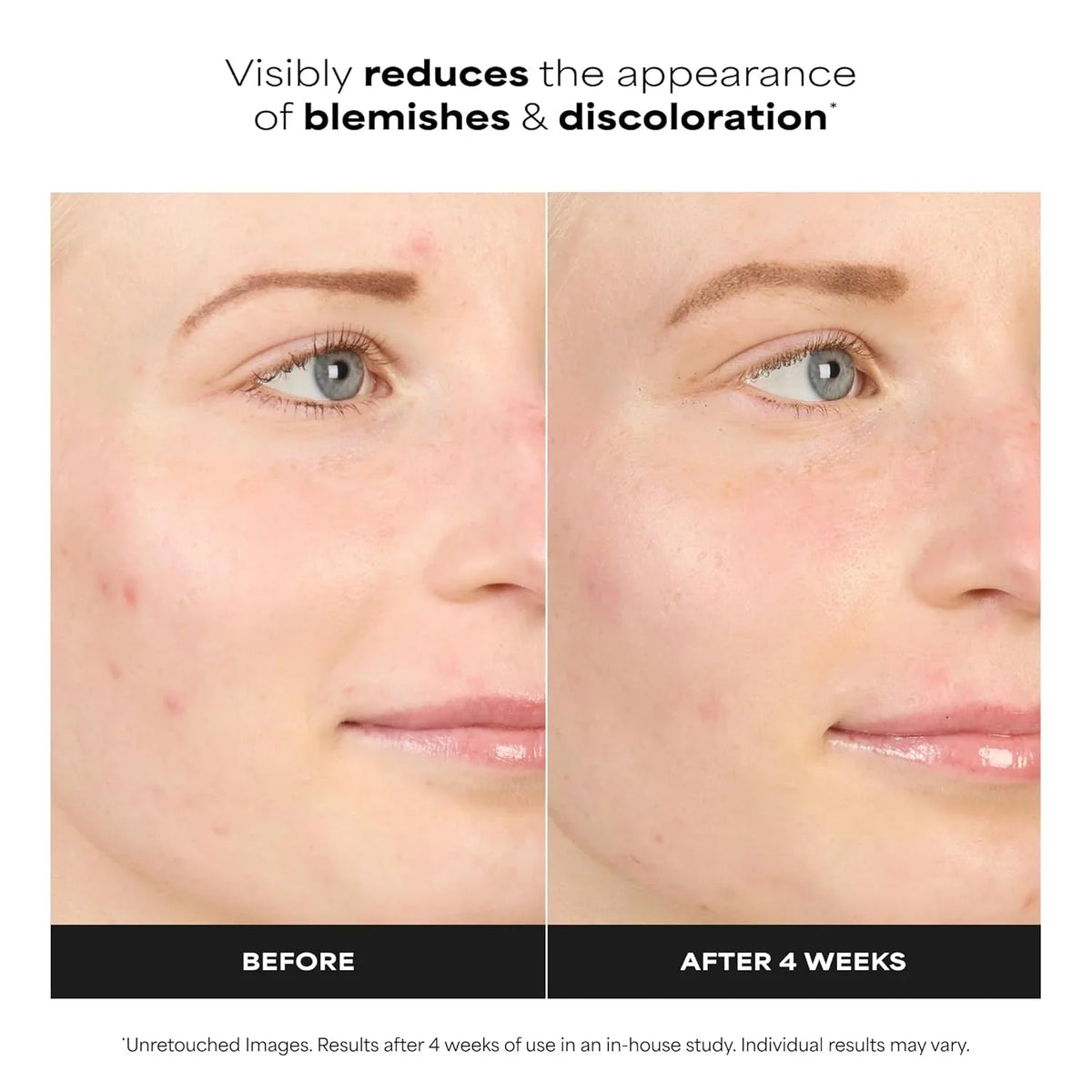 Paula's Choice BOOST 10% Azelaic Acid Booster Cream Gel Serum