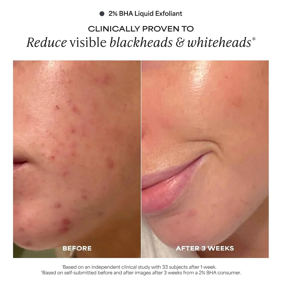 Paula's Choice Pro-Collagen Peptide Plumping Face Moisturizer