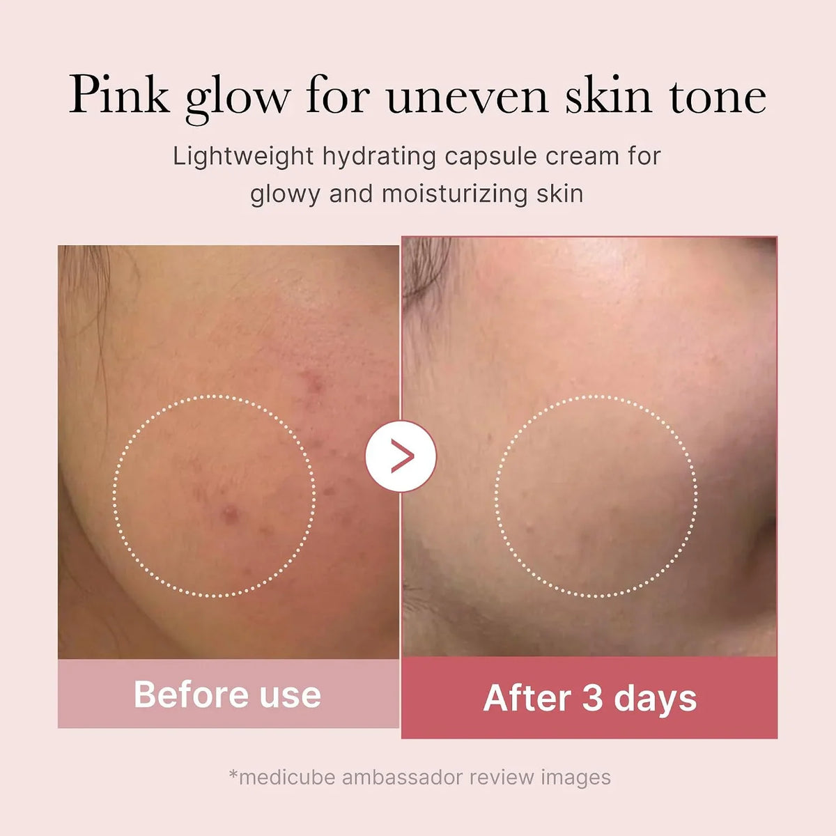 medicube Capsule Cream with Deep Vitamin C for Uneven Skin Tone & Texture