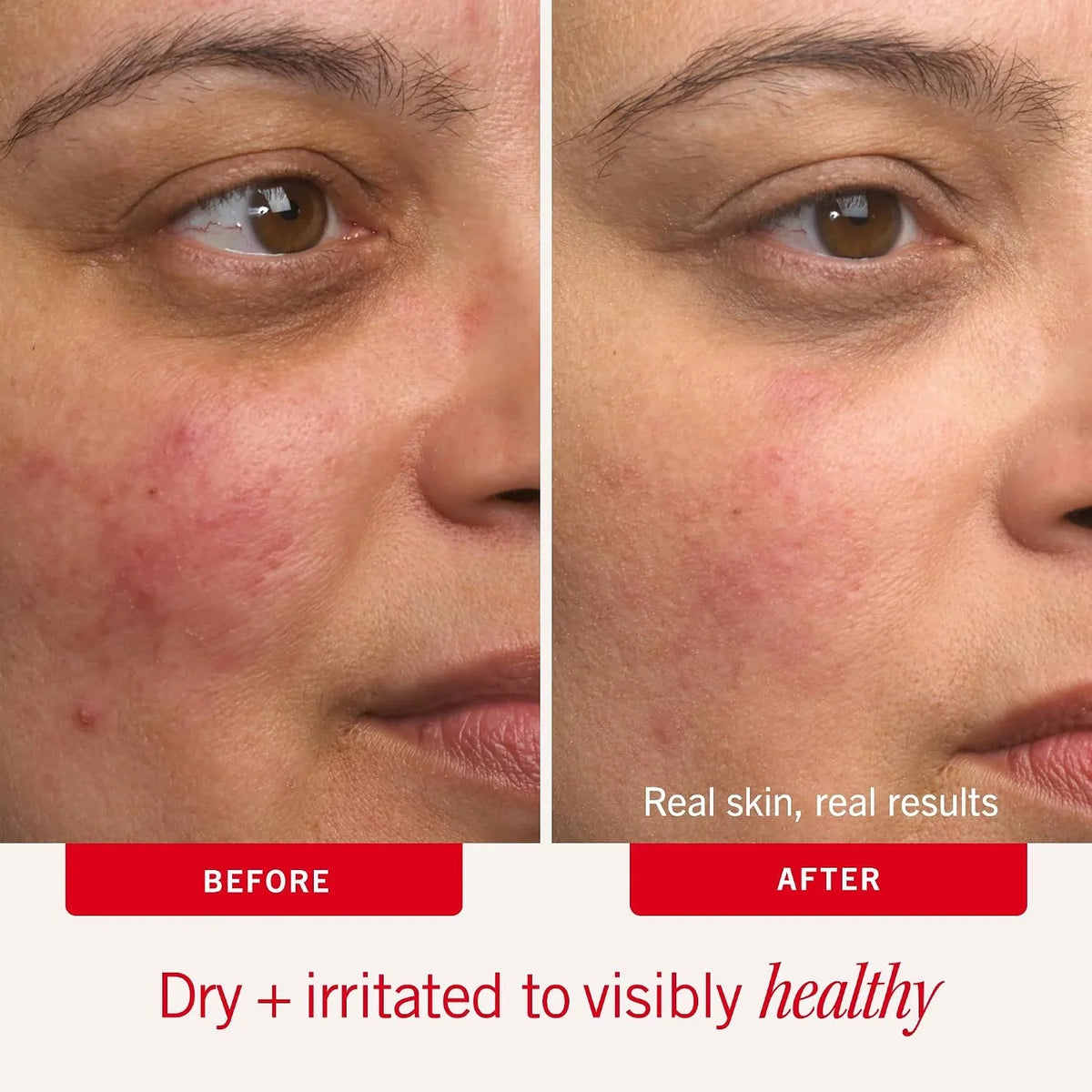 First Aid Beauty Ultra Repair Cream, Face Body Barrier Repair Moisturizer