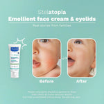 Mustela Stelatopia Eczema-Prone Skin Emollient Baby Face Cream - Face Moisturizer with Natural Avocado & Sunflower Oil - Fragrance-Free - 1.35 Fl Oz (Pack of 1)