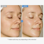 TOSOWOONG Hyaluronic Acid 9 Cream Daily Face Moisturizer for Hydration