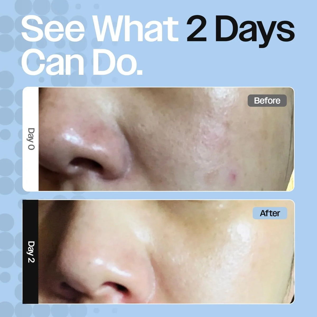 Skin Barrier Repair Cream for Eczema, Rosacea, Sensitive Dry Skin. Hydrating moisturizer, eczema relief cream soothes dry skin and redness. Face moisturizer & body cream for daily/nighttime use
