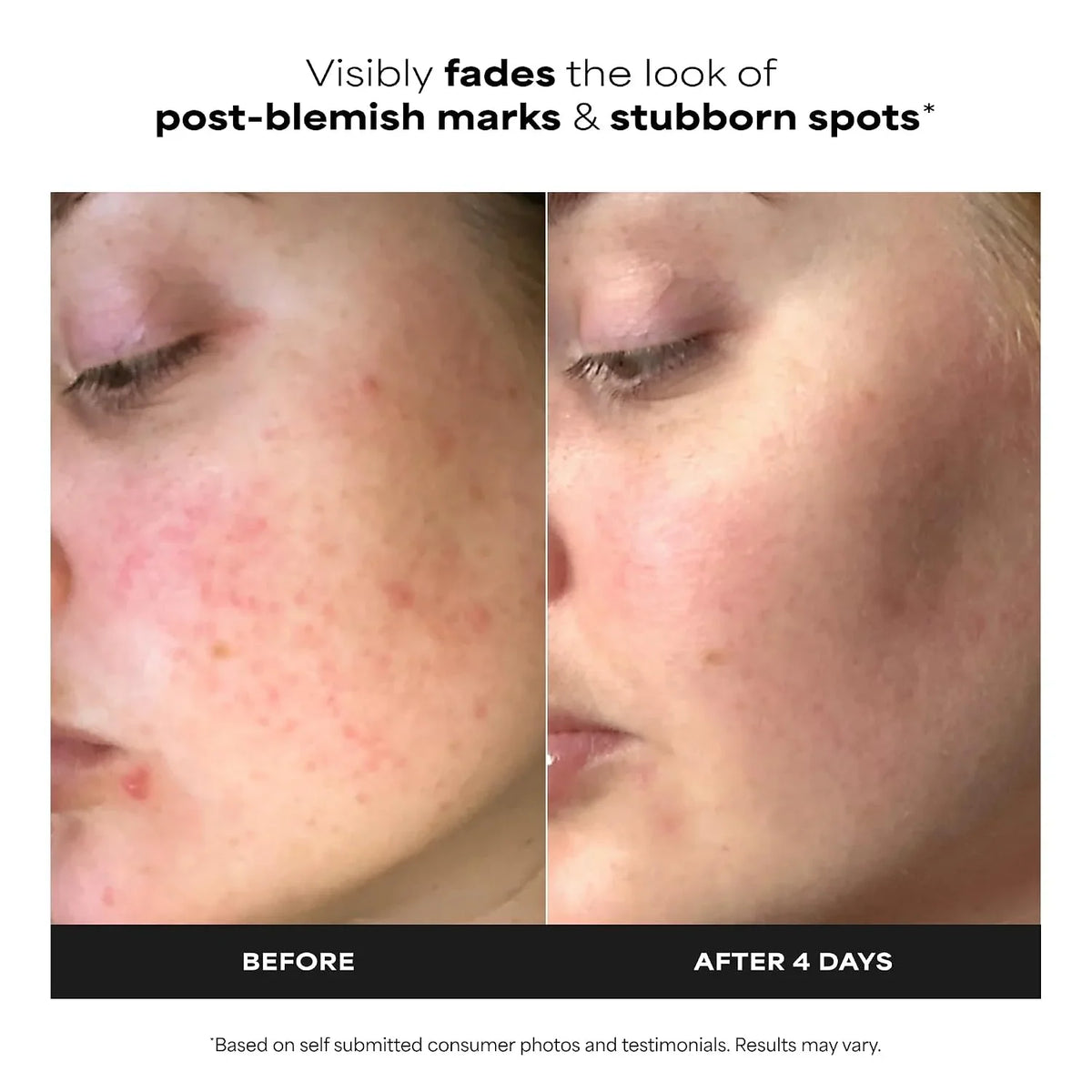 Paula's Choice BOOST 10% Azelaic Acid Booster Cream Gel Serum