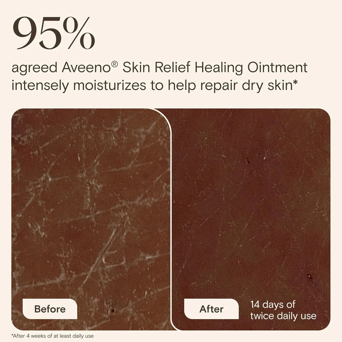 Aveeno Skin Relief Healing Ointment, Fragrance-Free, Jar 14 Ounce (Pack of 12)